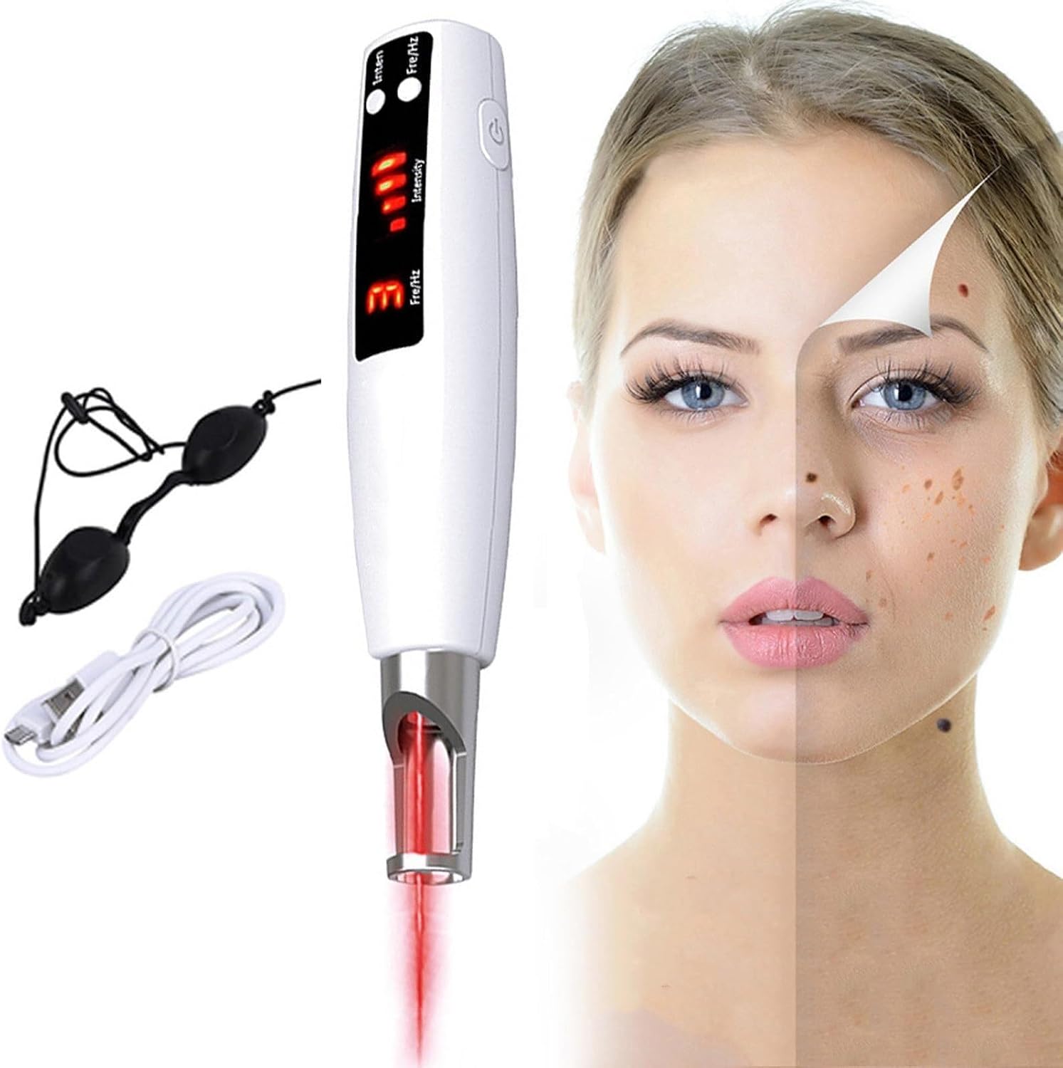 Picosecond Pen Plasma Device Freckle Scar Tattoo Removal Dark Spot Removal Machine, 9 Modes  4 Levels, LCD Display, with GlassesRed